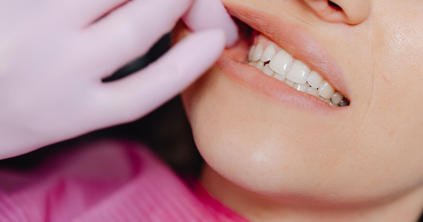 Macchie bianche sui denti dei bambini (MIH): come riconoscerle e cosa fare