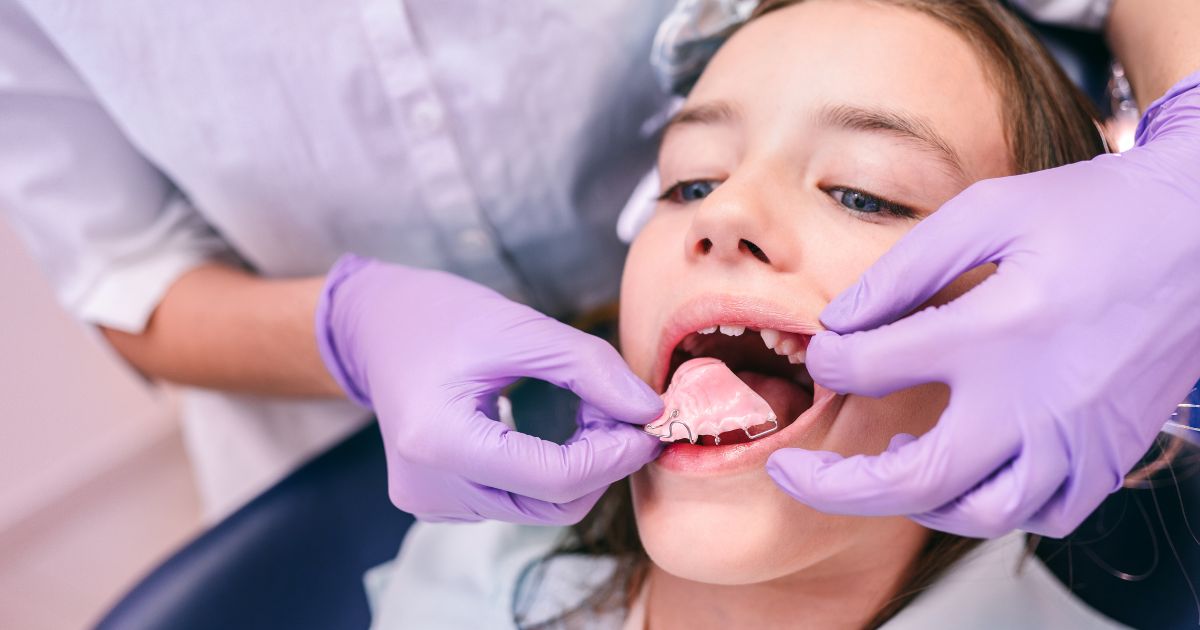 Apparecchi funzionali per bambini: cosa sono, a cosa servono e quali sono i vantaggi